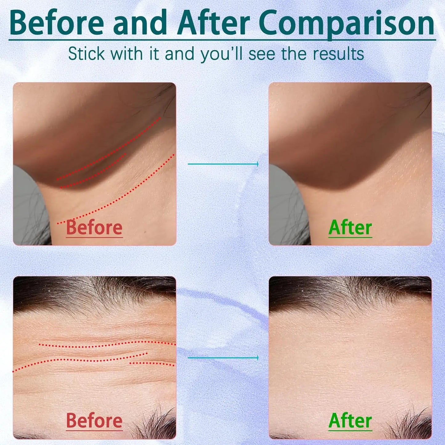 Korean Lights Red Light Therapy Wand™