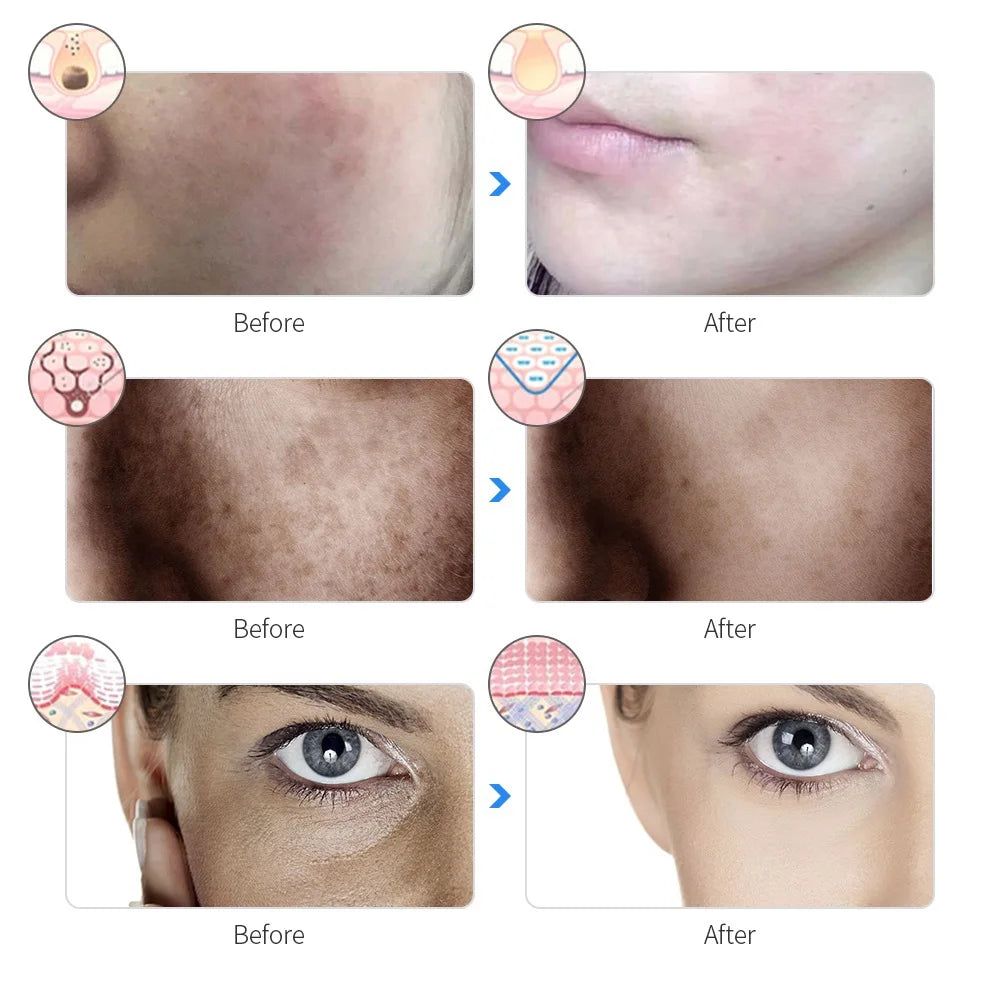 Korean Lights Red Light Therapy Mask™